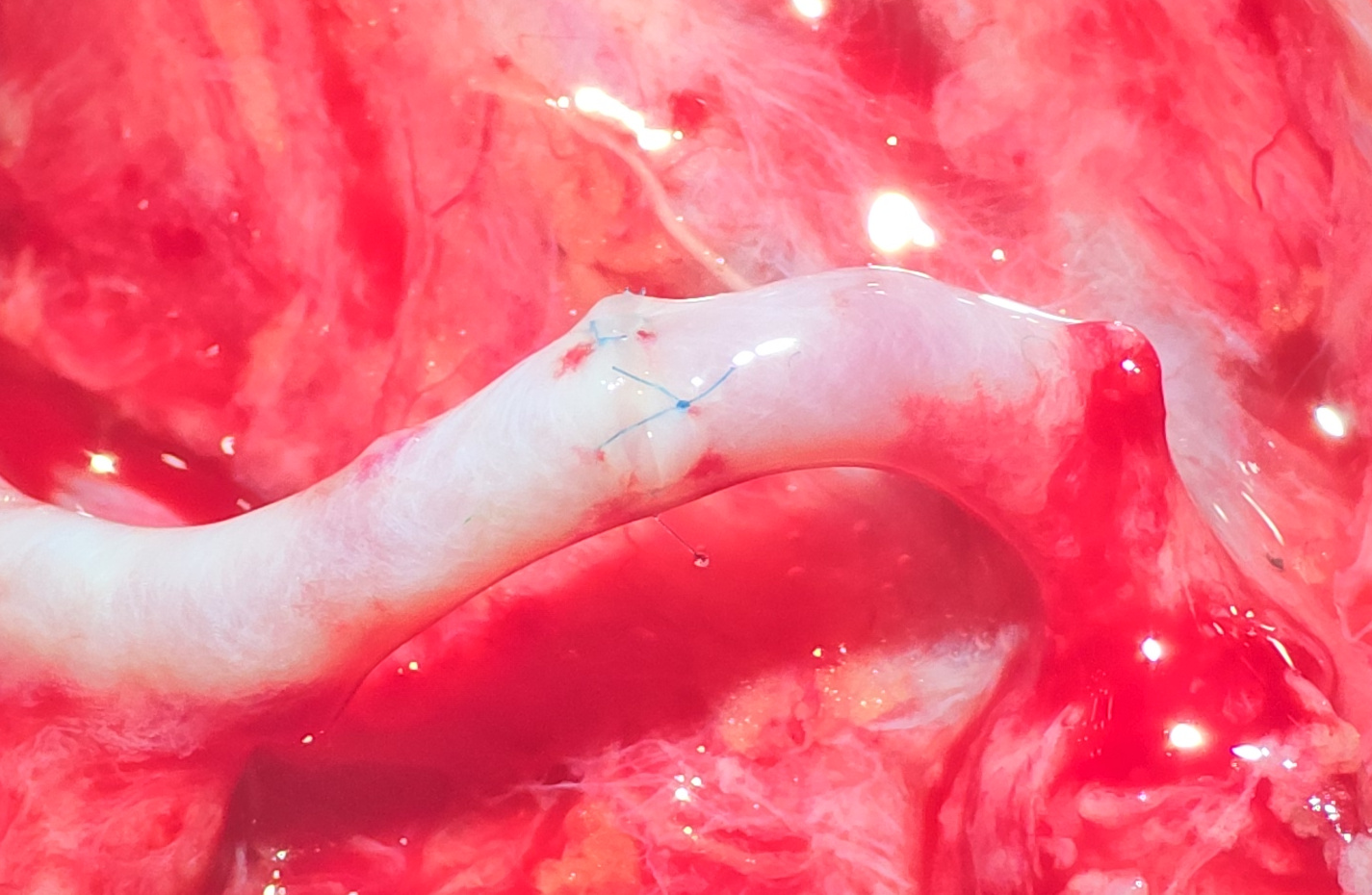 Post-operative view at recovery showing intact facial contour and preserved oral opening